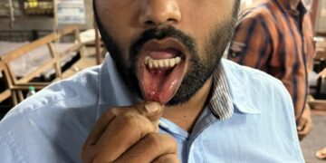 వెంకటేష్‌ను ఇష్టమొచ్చినట్లు కొట్టి రిపోర్టును తారుమారు చేస్తారా?